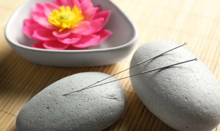 Is Acupuncture the Right Treatment for Me?